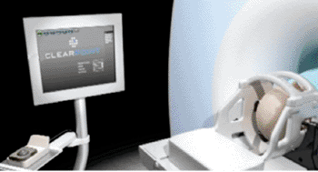 Imagen B: El dispositivo ClearPoint SmartFrame es un marco de trayectoria desechable, de un solo uso, que es compatible con RM y permite la alineación guiada por RM y la inserción de dispositivos usados durante los procedimientos ClearPoint (Fotografía cortesía de MRI Interventions).